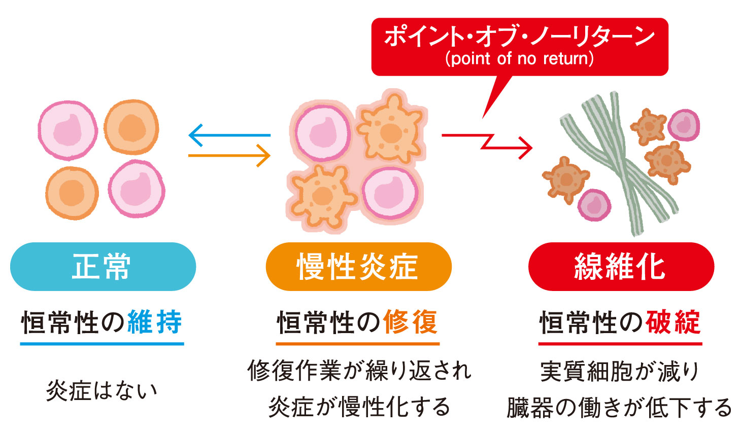 慢性炎症から線維化へ進行する過程とポイント・オブ・ノーリターンの概念図