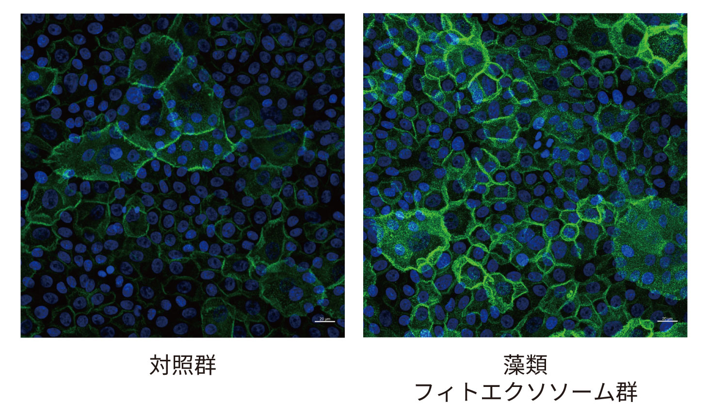 repair.jpg
藻類フィトエクソソームによる皮膚バリア再建の促進を示す細胞画像
