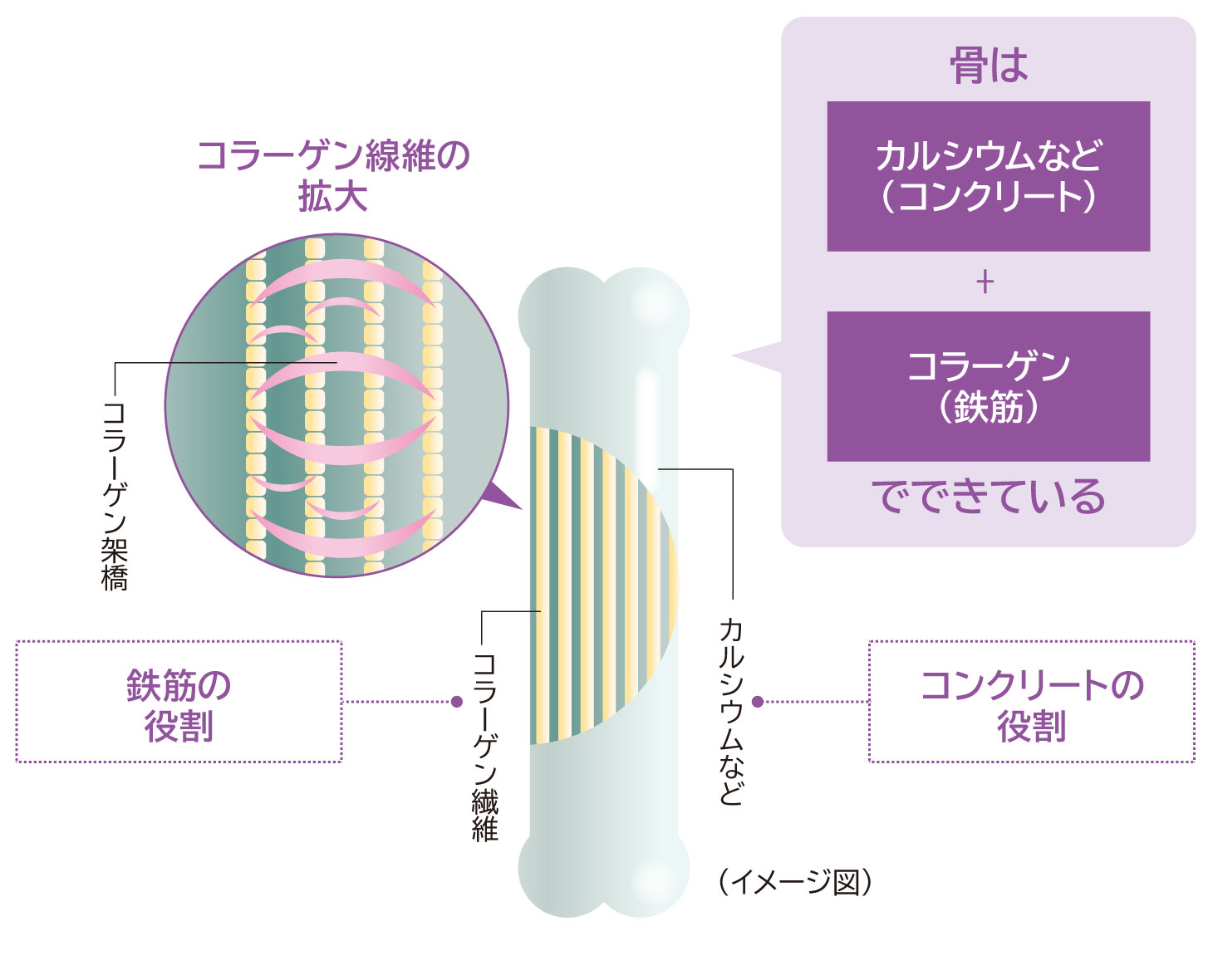 加齢やエストロゲン低下により骨密度と骨質が低下し、骨粗しょう症に進行する仕組みの図解