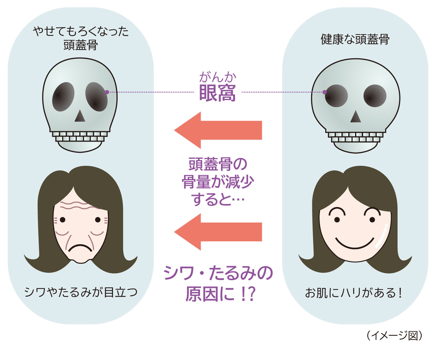 骨はコラーゲン（鉄筋）とカルシウム（コンクリート）で構成され、しなやかさと強度を保っている構造図