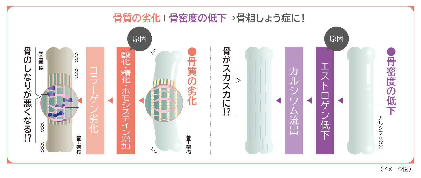 酸化・糖化・ホモシステイン増加によってコラーゲン架橋が劣化し、骨がもろくなる仕組みの図