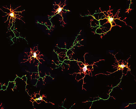 脳の神経細胞（ニューロン）の画像